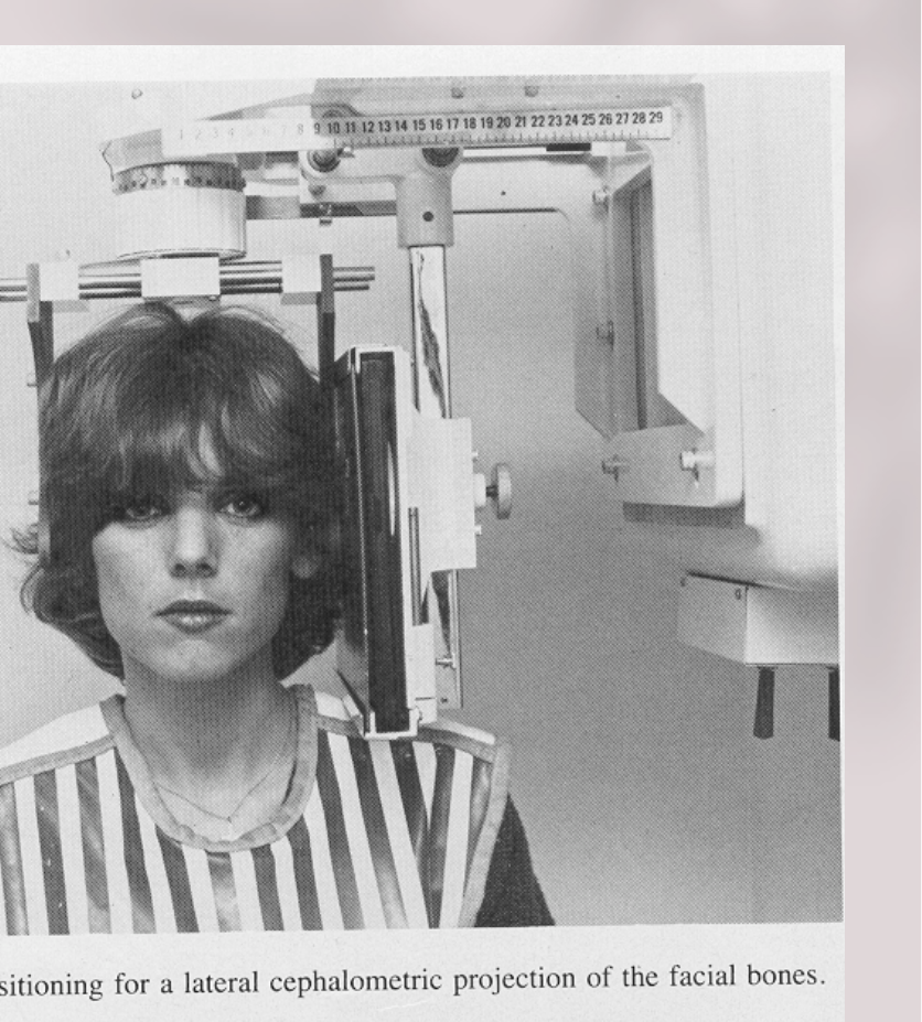 FIG. 11-4. Patient positioning for a lateral cephalometric projection of the facial bones.