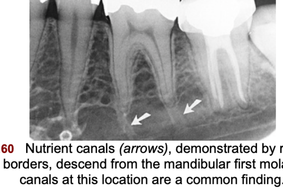FIG. 12.60 Nutrient canals (arrows), demonstrated by radiopaque cortical borders, descend from the mandibular first molar. Nutrient canals at this location are a common finding.