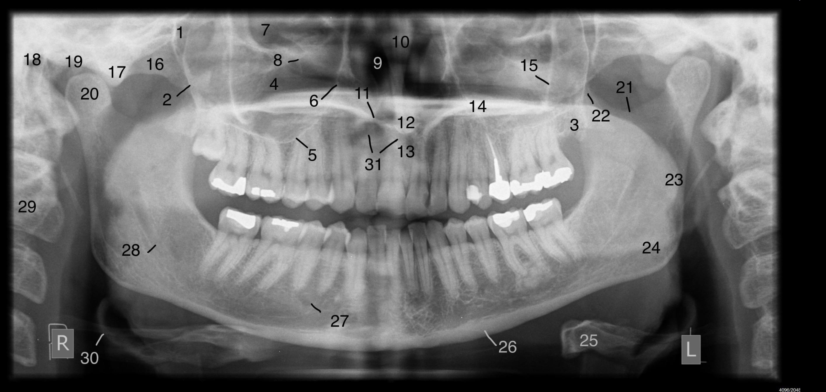 Case 9 – Identify all structures
