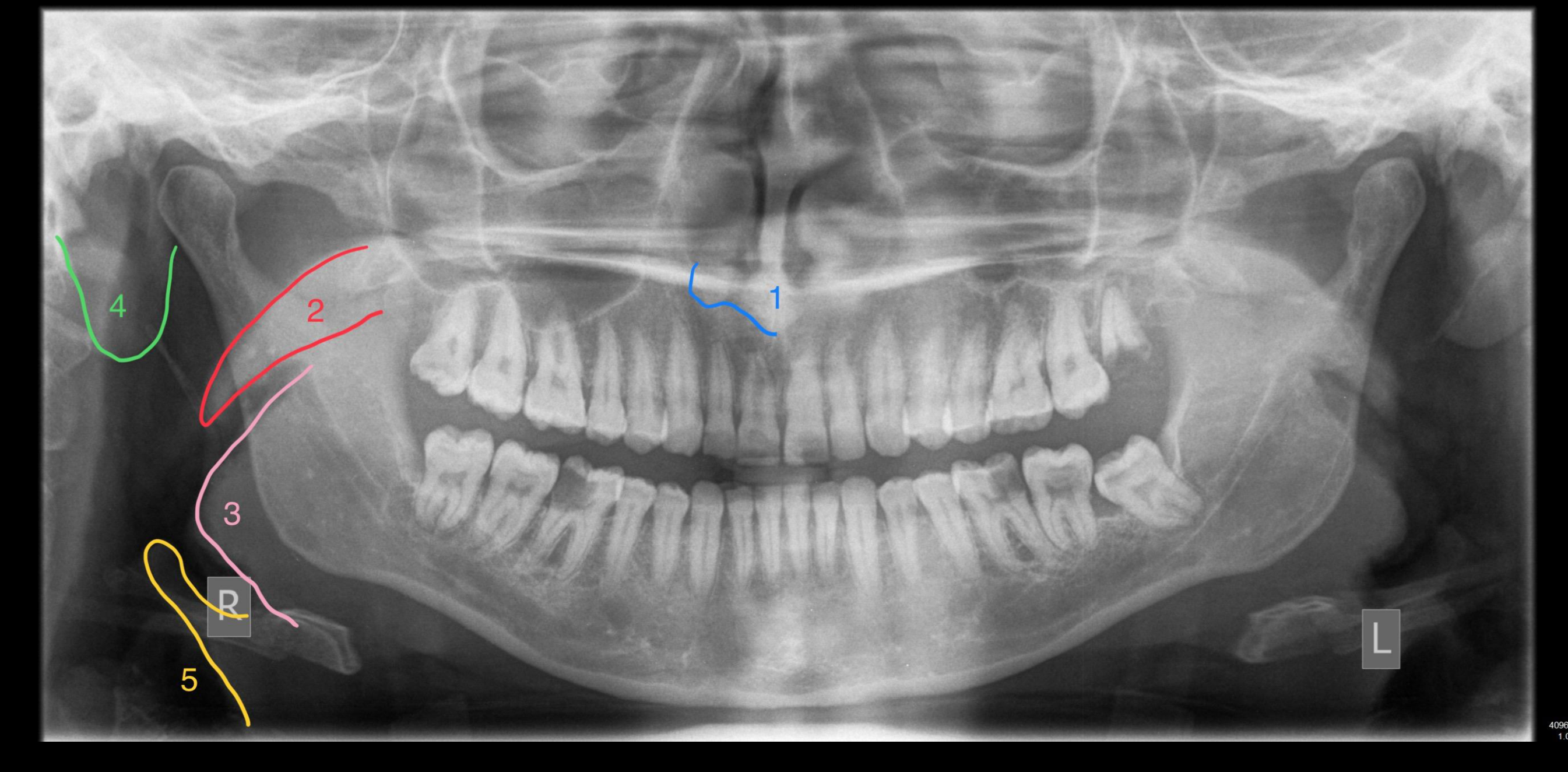 Case 7 – Soft Tissue Structures
