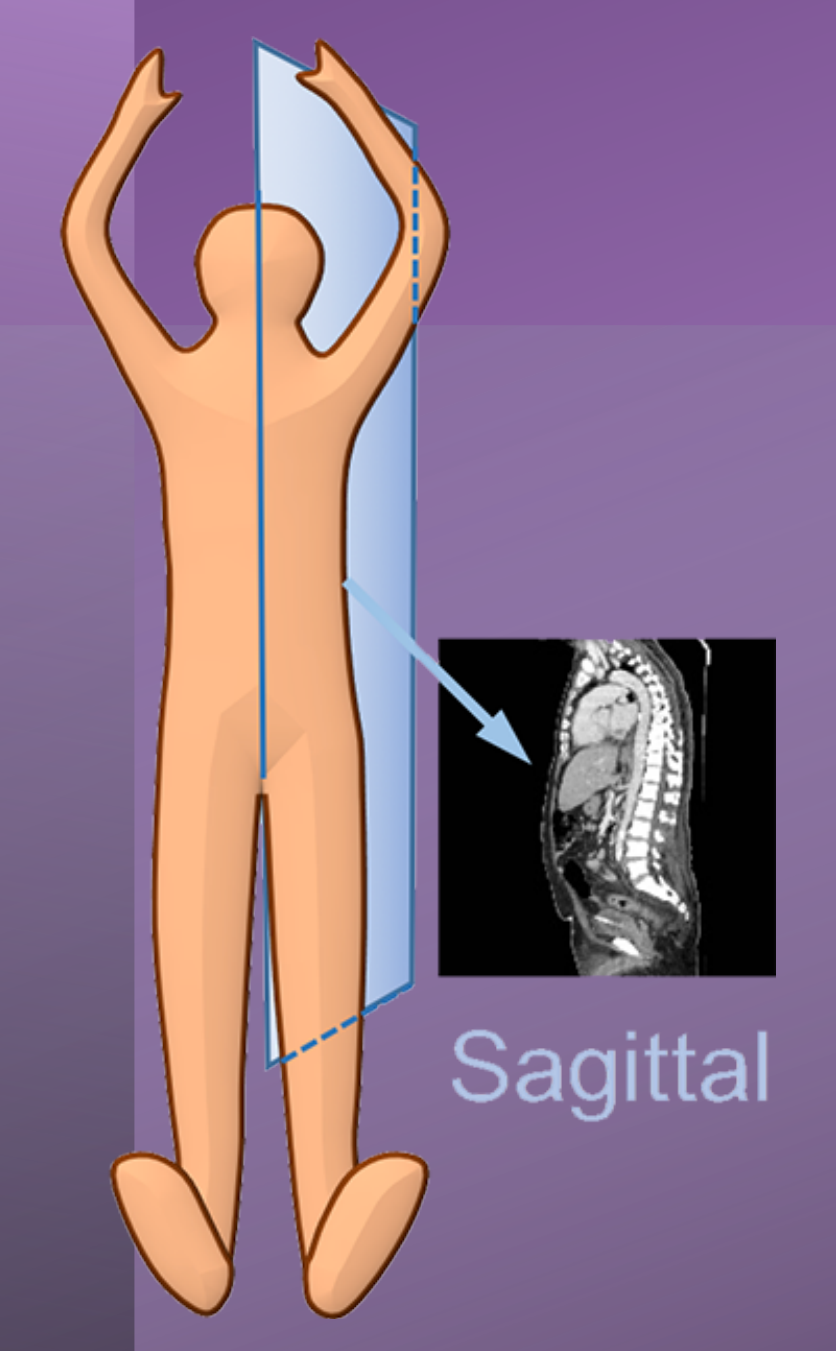 Sagittal