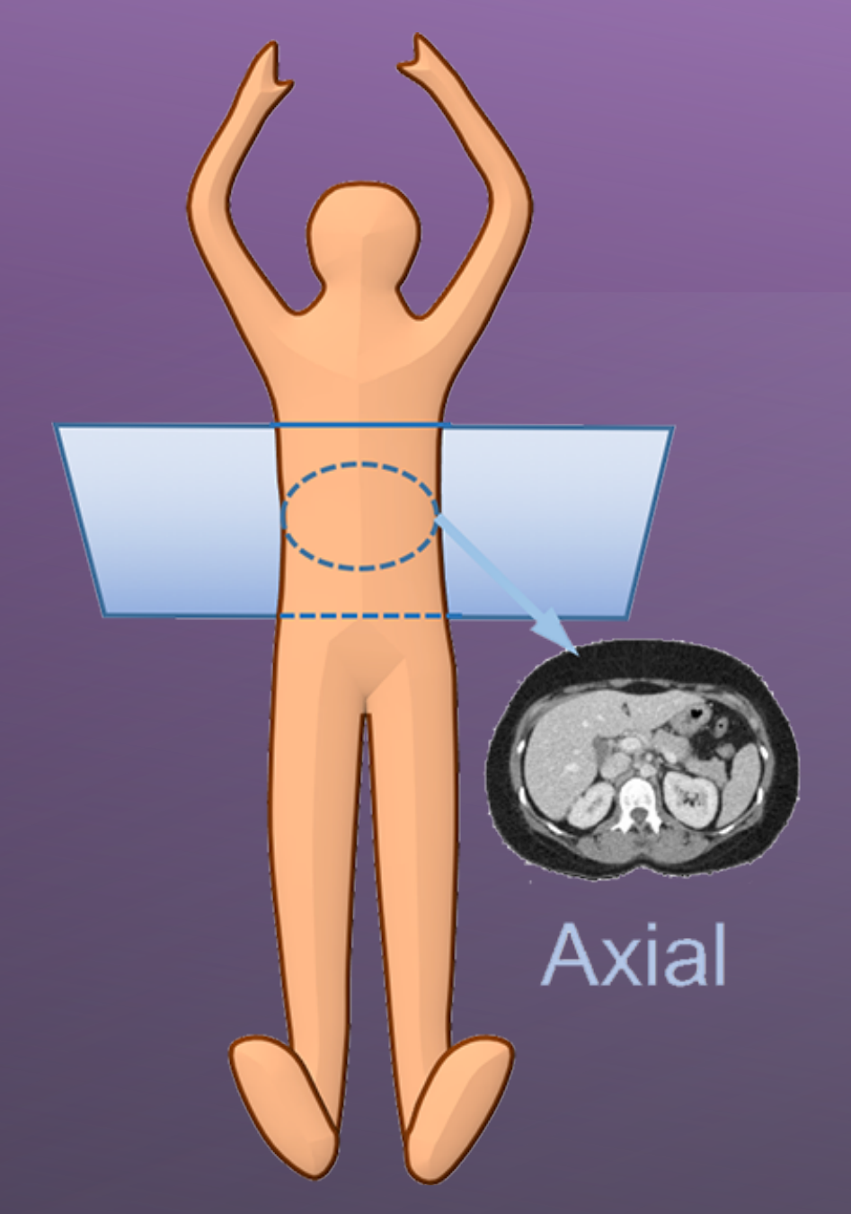 Axial