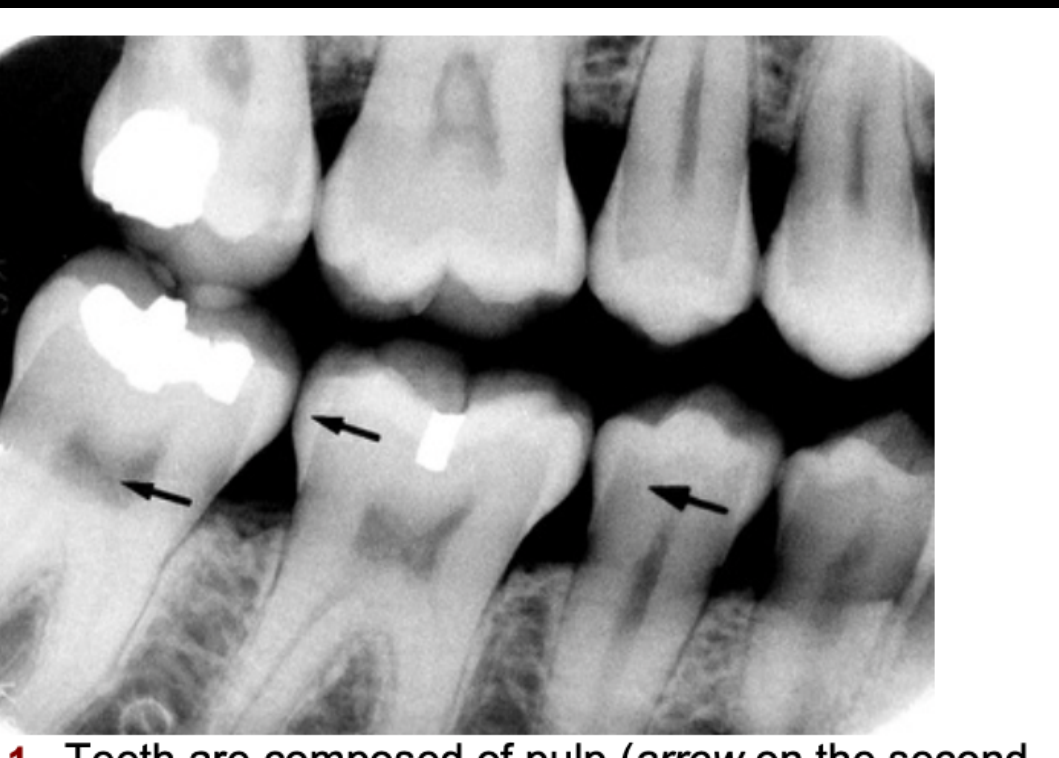 FIG. 12.1 Teeth are composed of pulp (arrow on the second molar), enamel (arrow on the first molar), dentin (arrow on the second premolar), and cementum (usually not visible radiographically).