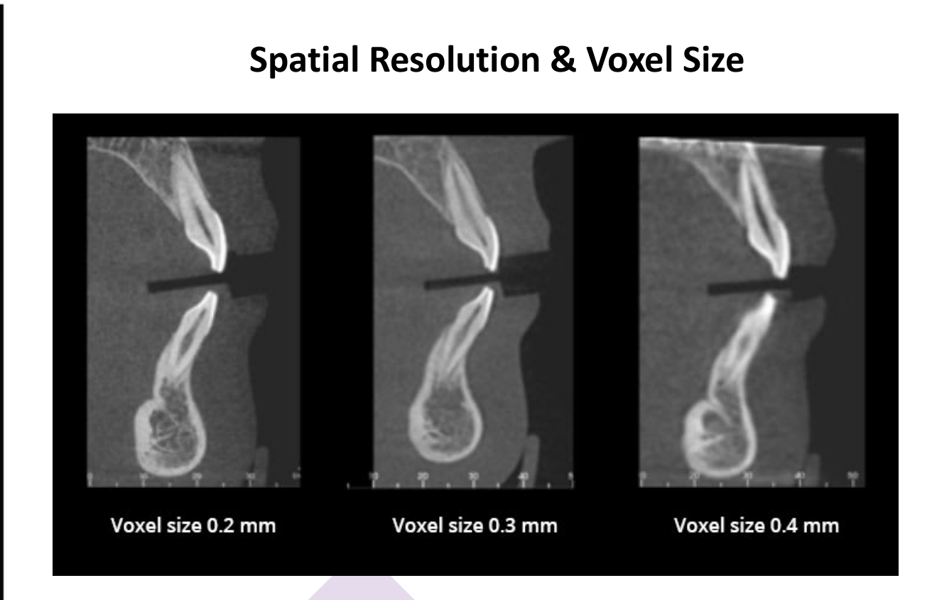 Spatial Resolution & Voxel Size