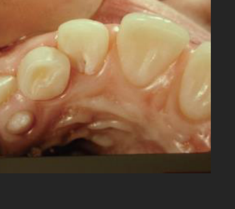 (b)