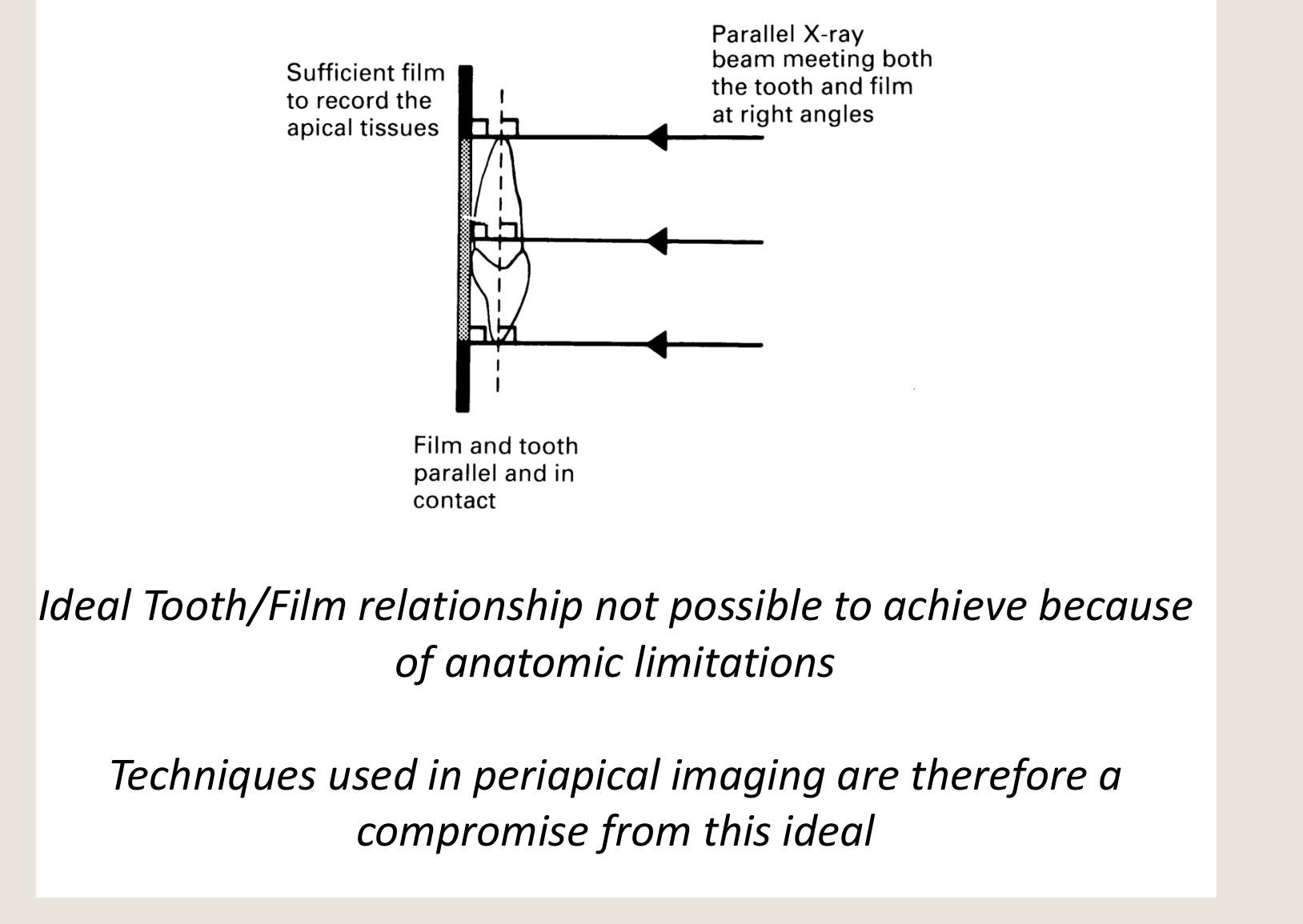 Ideal Tooth/Film relationship not possible to achieve because of anatomic limitations Techniques used in periapical imaging are therefore a compromise from this ideal