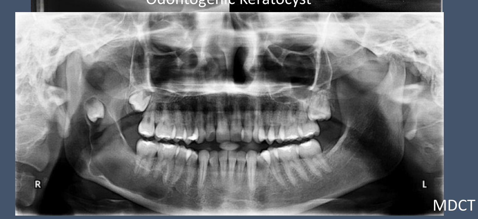MDCT review