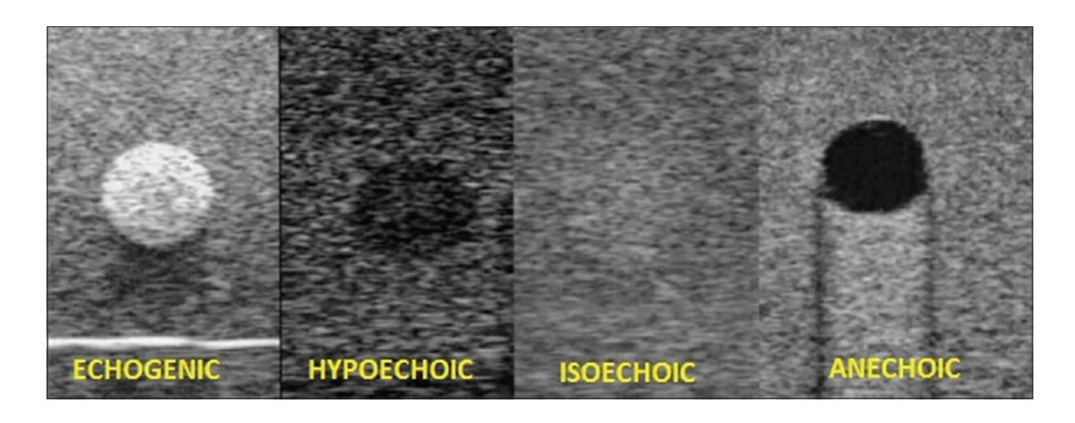 ECHOGENTIC HYPOECHOIC ISOECHOIC ANECHOIC