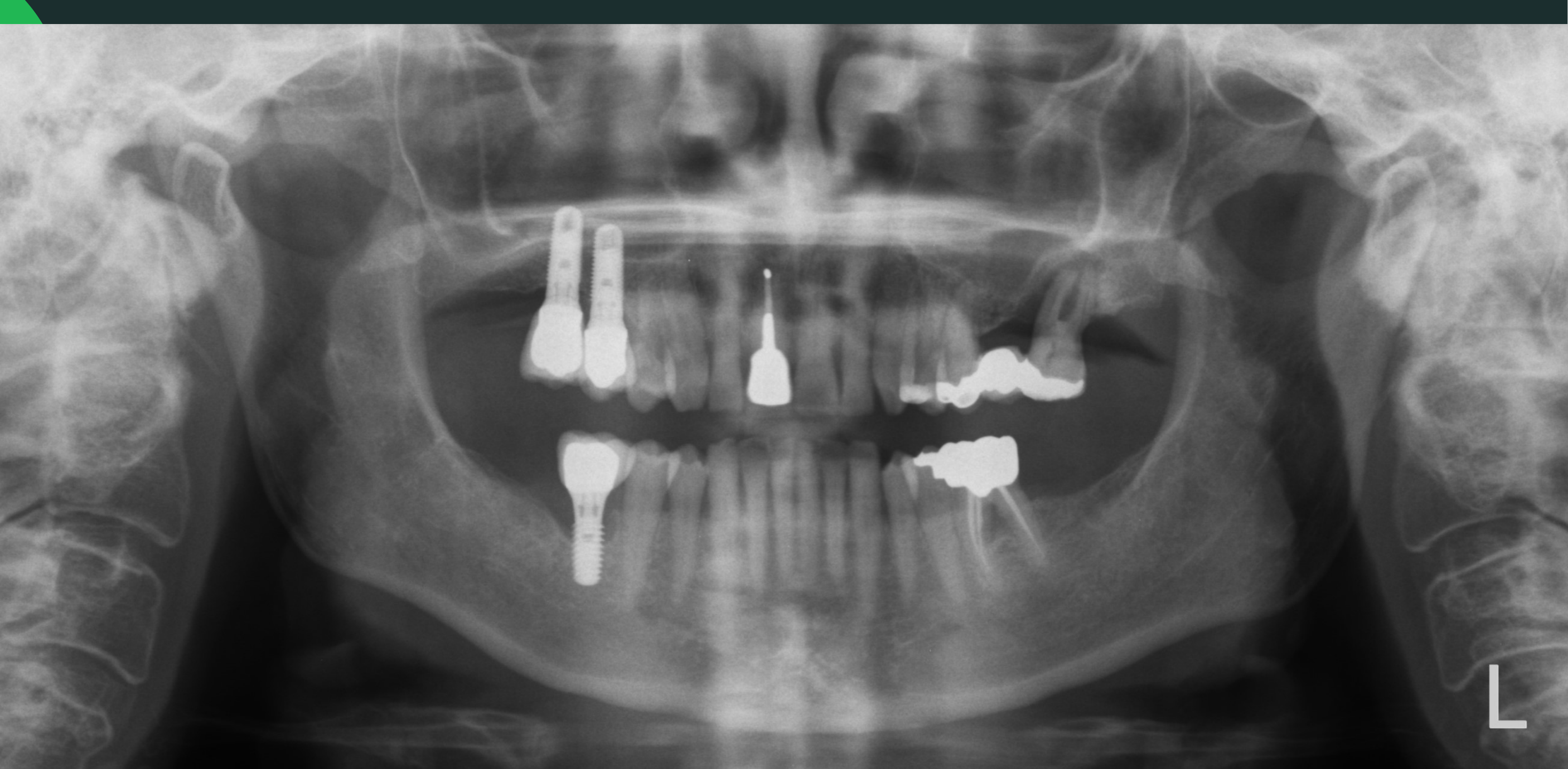 Case 2. Periodontal Disease