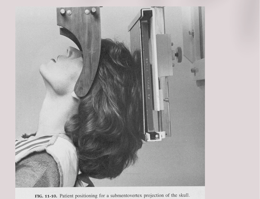 FIG. 11-10. Patient positioning for a submentoverex projection of the skull.