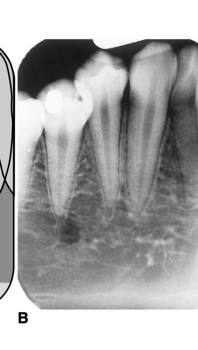 B. Radiograph showing corresponding anatomical structures in vivo.