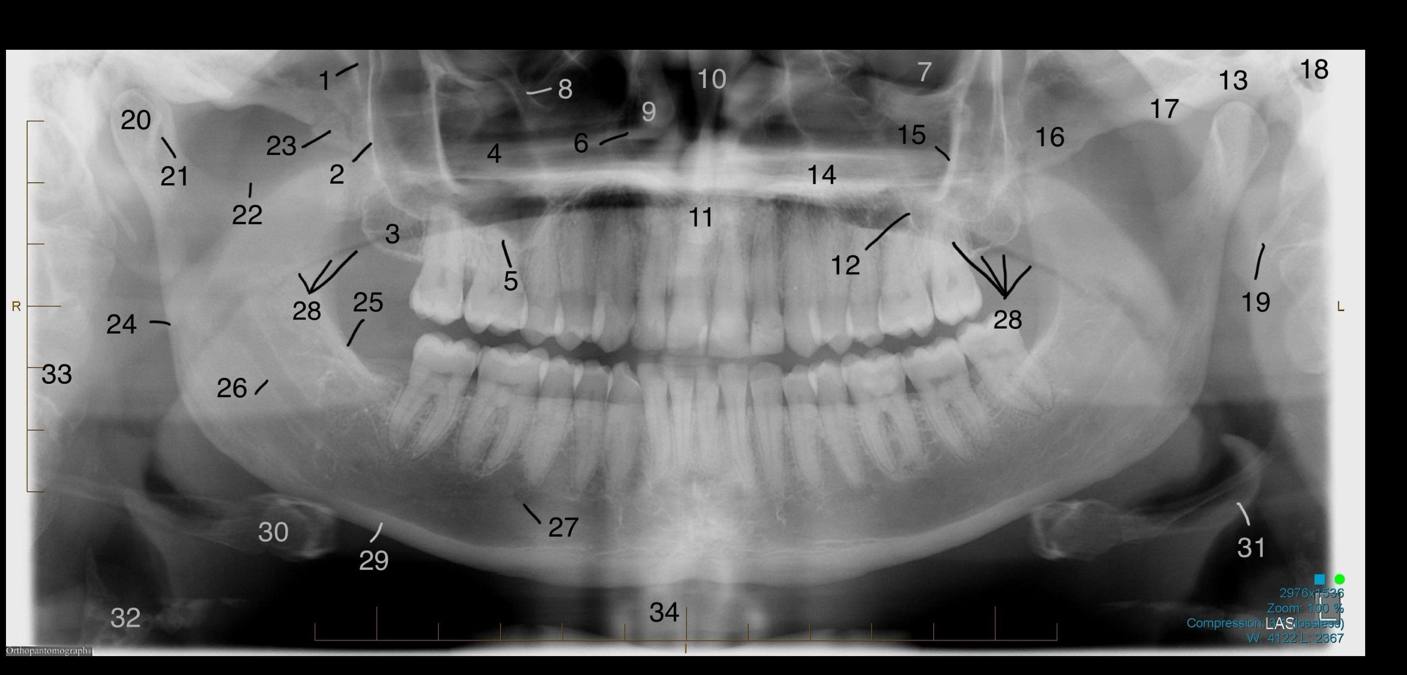 Case 10 – Identify all structures