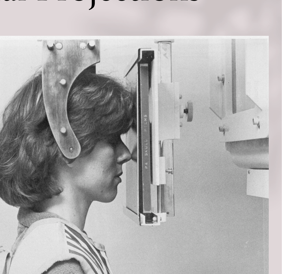 FIG. 11-2. Patient positioning for a posteroanterior cephalometric projection of the skull.