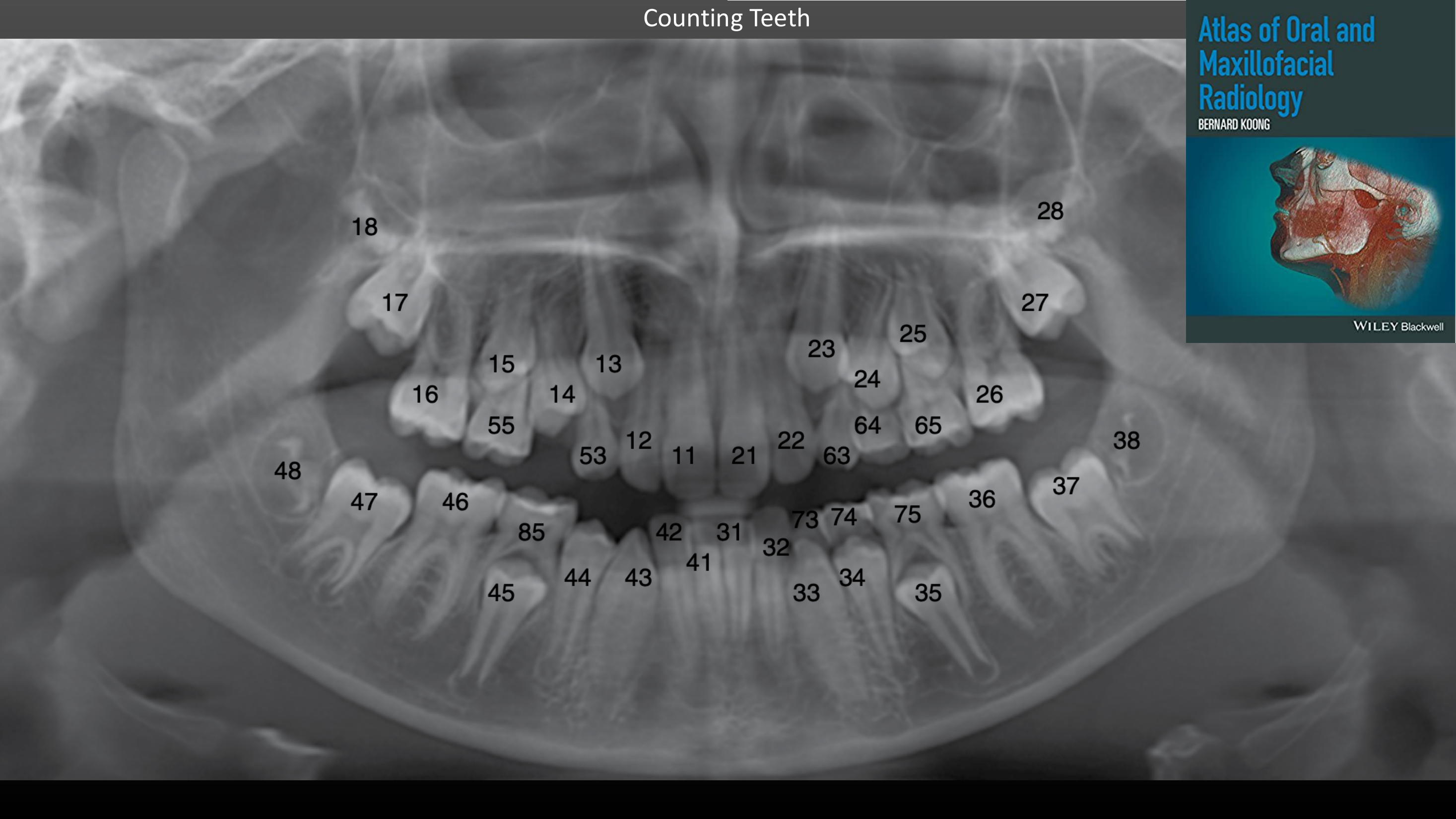 Counting Teeth