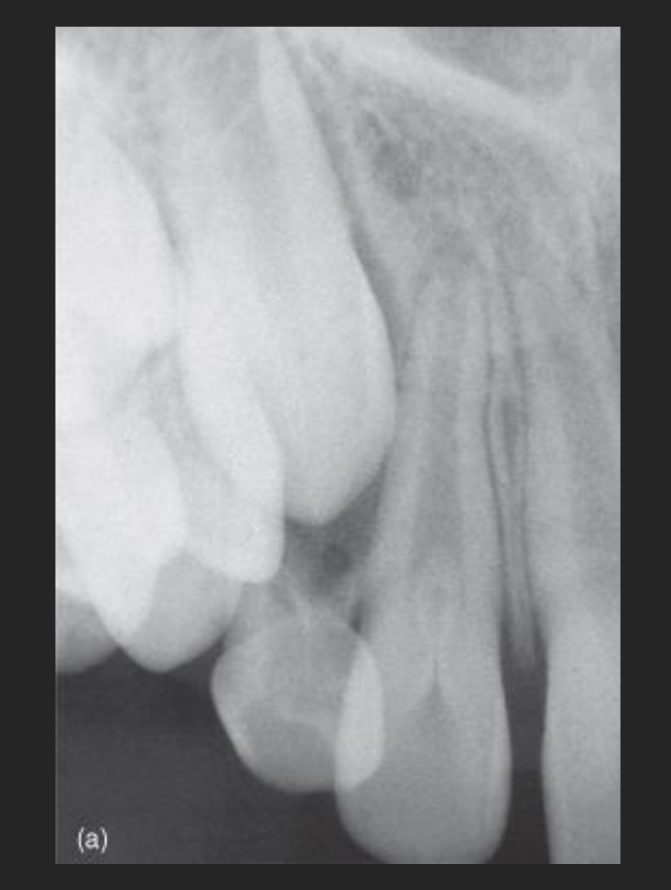 (a)
