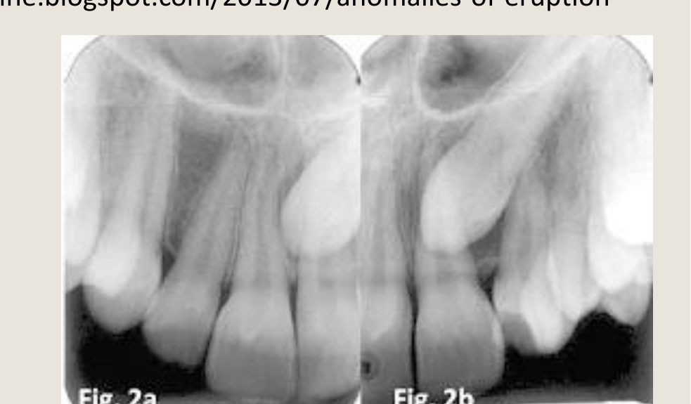 Fig. 2a Fig. 2b