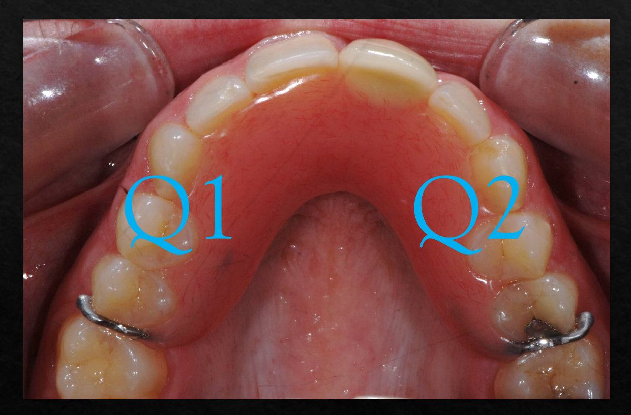 Q1 Q