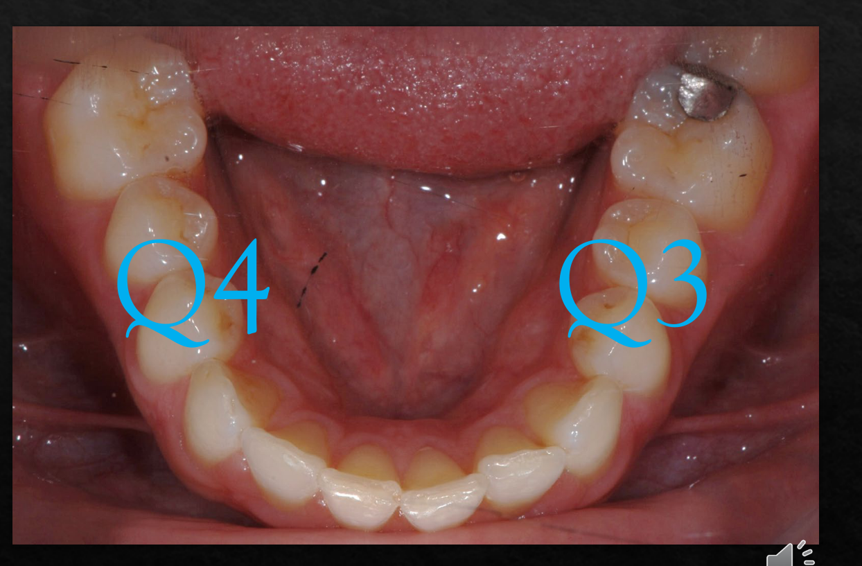 Q4 Q