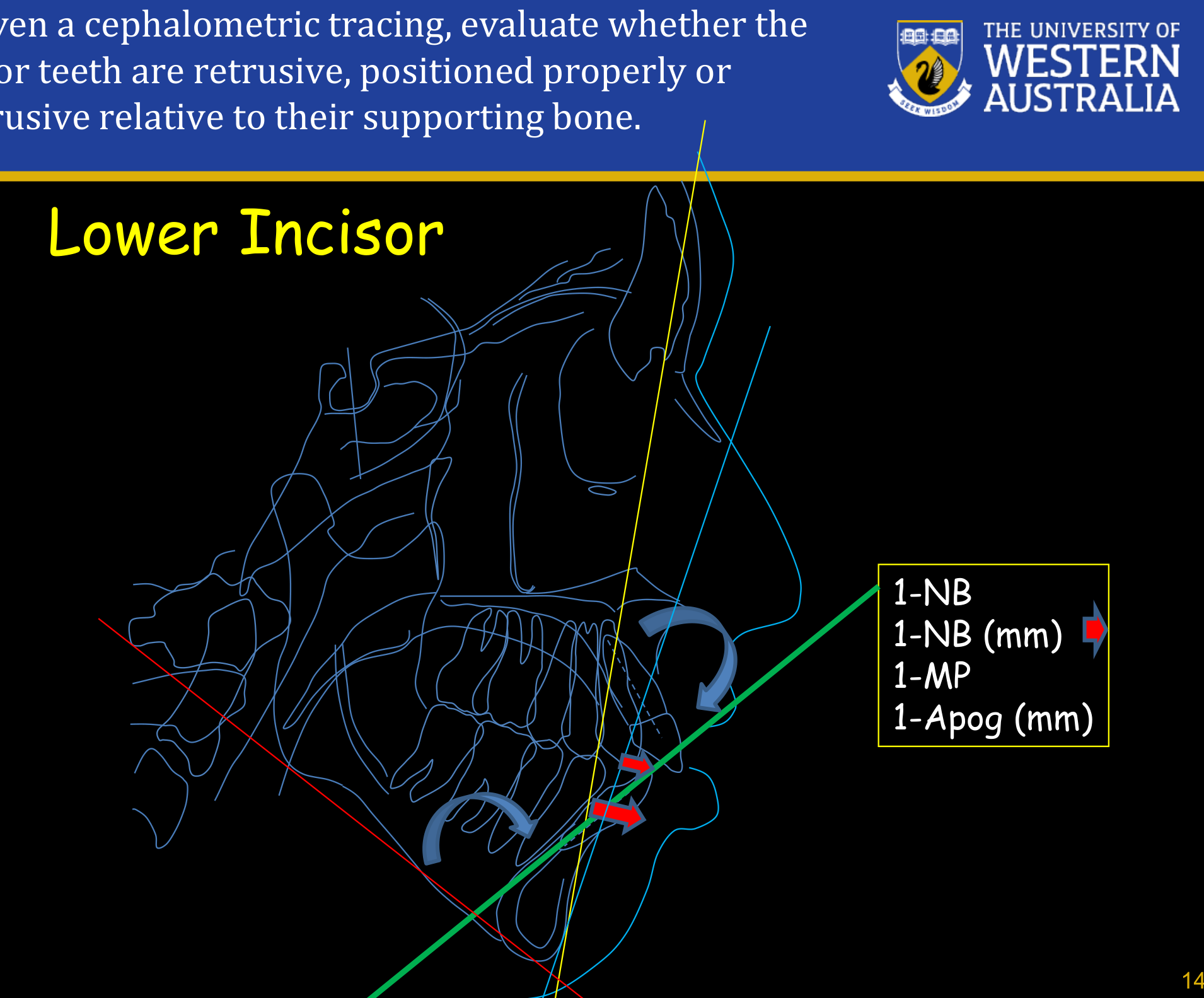Lower Incisor