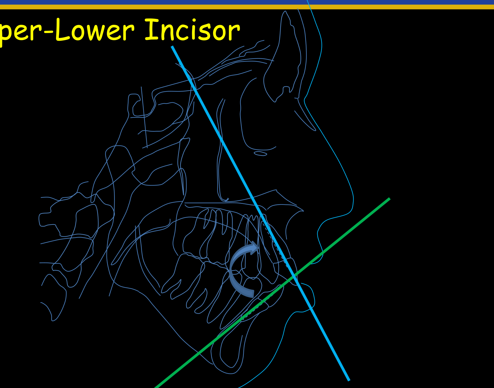 Upper-Lower Incisor