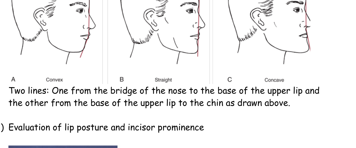 Convex (A), Straight (B) and Concave (C) profile drawings with the reference line, and the two-line instruction spelled out beneath