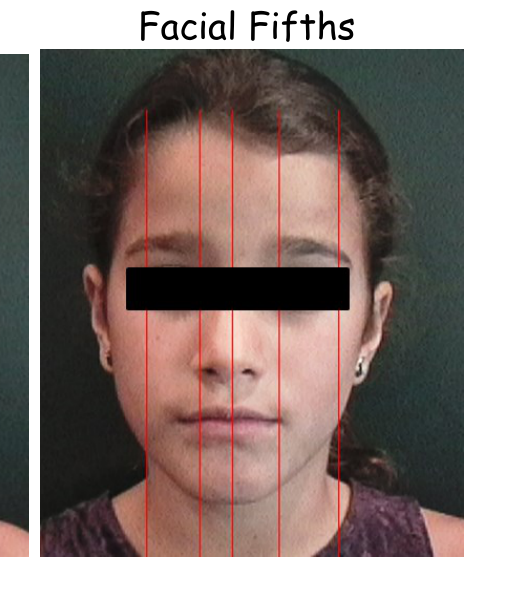 Facial Fifths — five vertical red lines dividing the face into equal columns