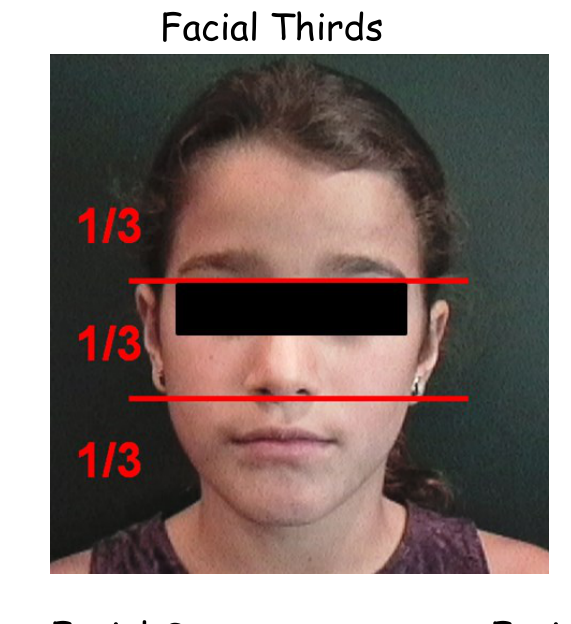 Facial Thirds — three equal horizontal divisions labelled 1/3, 1/3, 1/