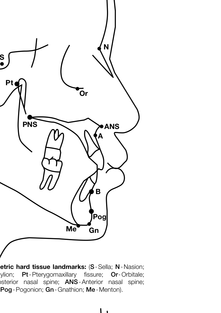 Figure 1. Cephalometric hard tissue landmarks: (S-Sella; N-Nasion; Po-Prion; Cd-Condylion; Pt-Pterygomaxillary fissure; Or-Orbitale; Ar-Artiulare; PNS-Posterior nasal spine; ANS-Anterior nasal spine; A-A point; B-B point; Pog-Pogonion; Gn-Gnathion; Me-Menton).