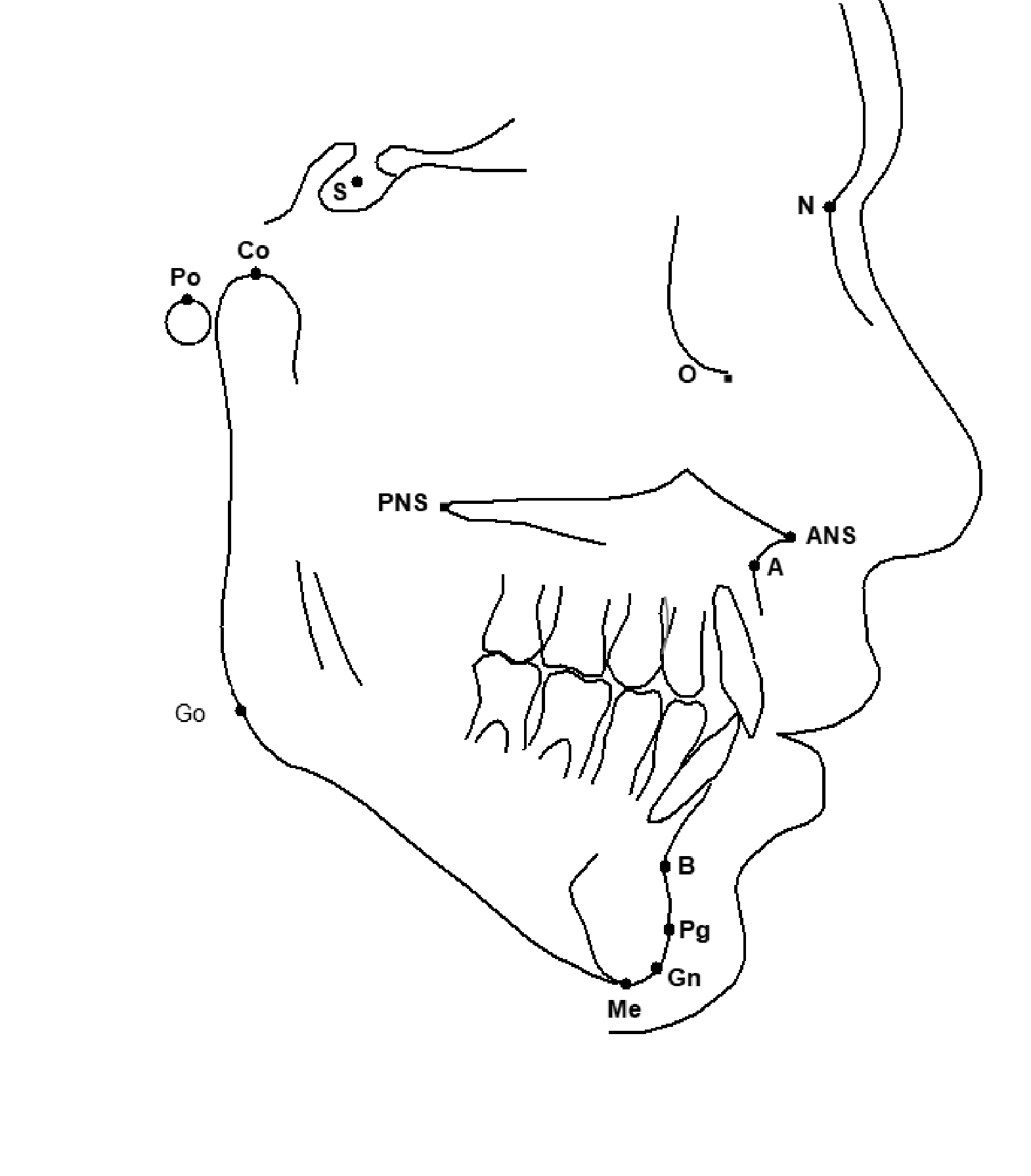 LANDMARK IDENTIFICATION FOR STANDARD UNC/UWA CEPHALOMETRIC ANALYSIS