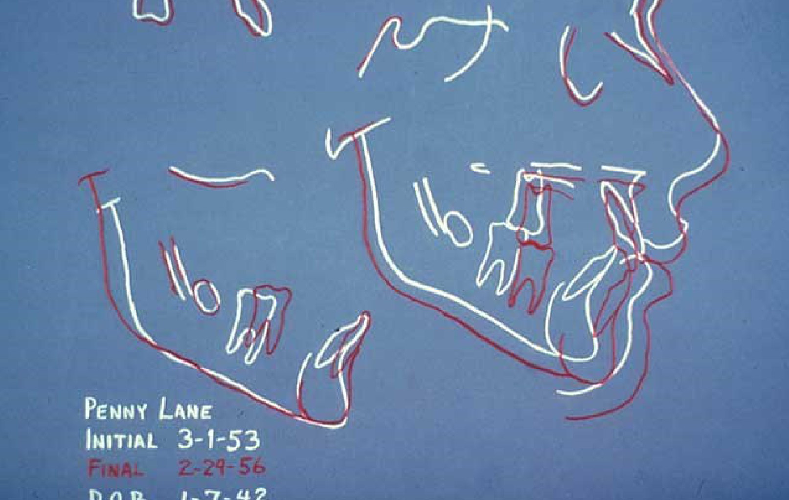 Penny Lane Initial 3-1-53 Final 2-29-56 D.O.B. 1-7-