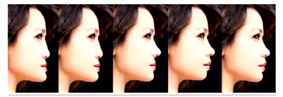 Figure 2: Sagittal views best demonstrate which specialists should be involved in treatment, whether orthodontists or maxillofacial surgeons, to best esthetically alter the facial esthetics.