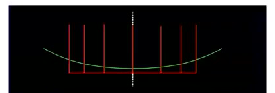 3. Interdental proportion