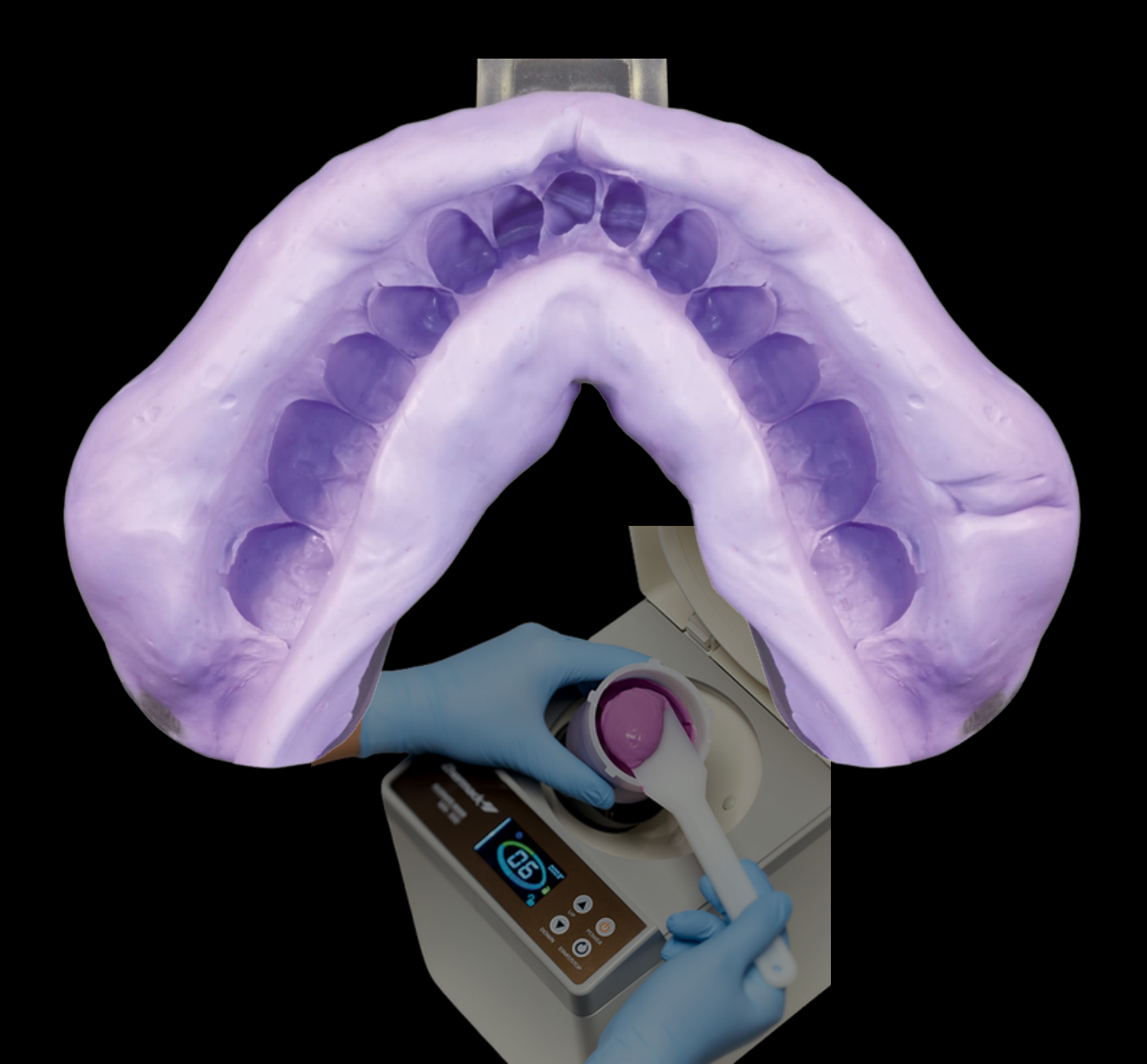 Alginate