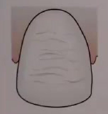 (a)