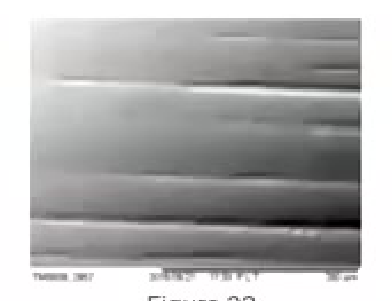 Figure 22 After rubber polishers in Air driven hand piece
