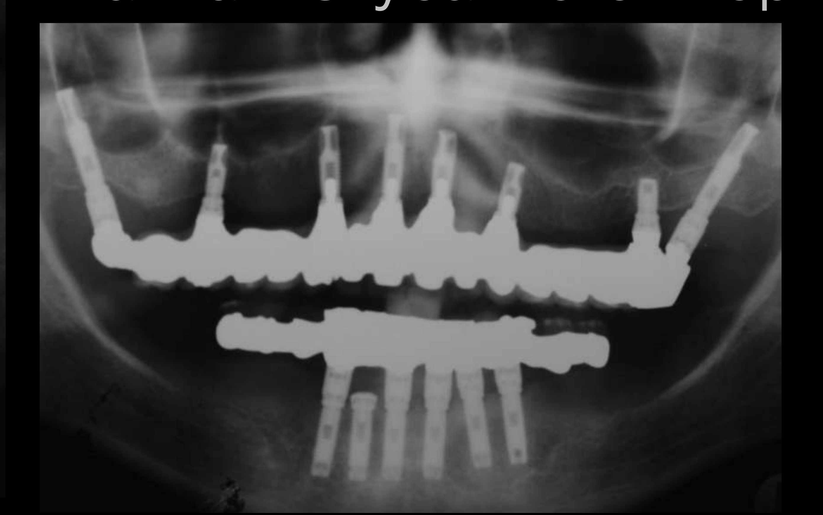 Axial CT scan (C1) and Osseous contour details