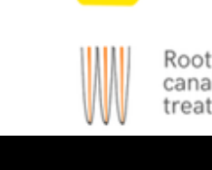 Root canal treated