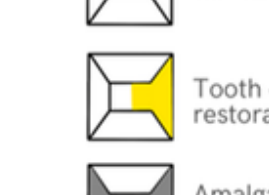Tooth coloured restoration