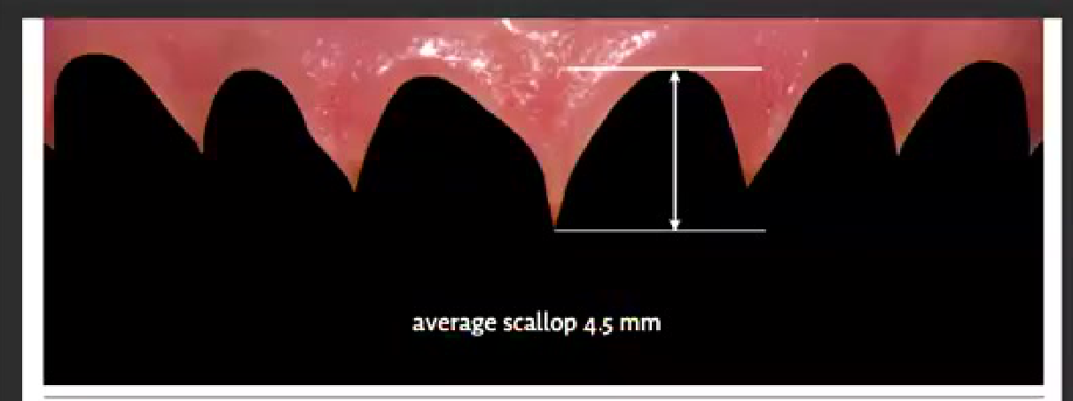 avg scallop 4.5 mm