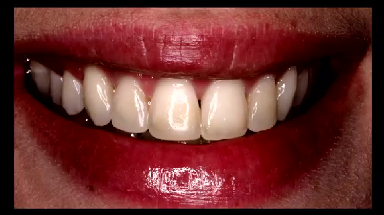 Cross-sectional imaging of teeth demonstrating pulpal status