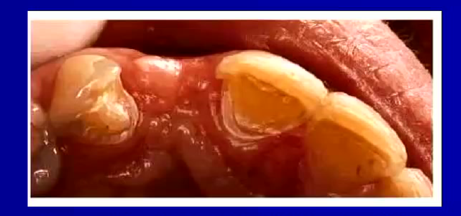 http://www.scribd.com/files/limba/engleza/health/177_poze/image040.jpg