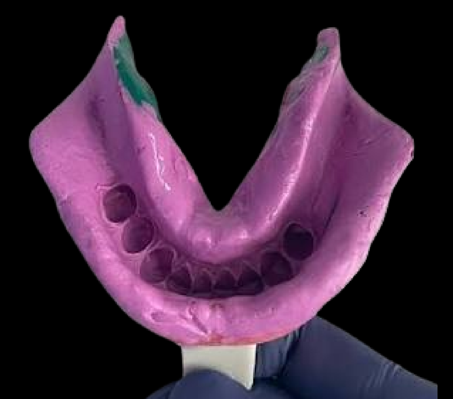 Alginate
