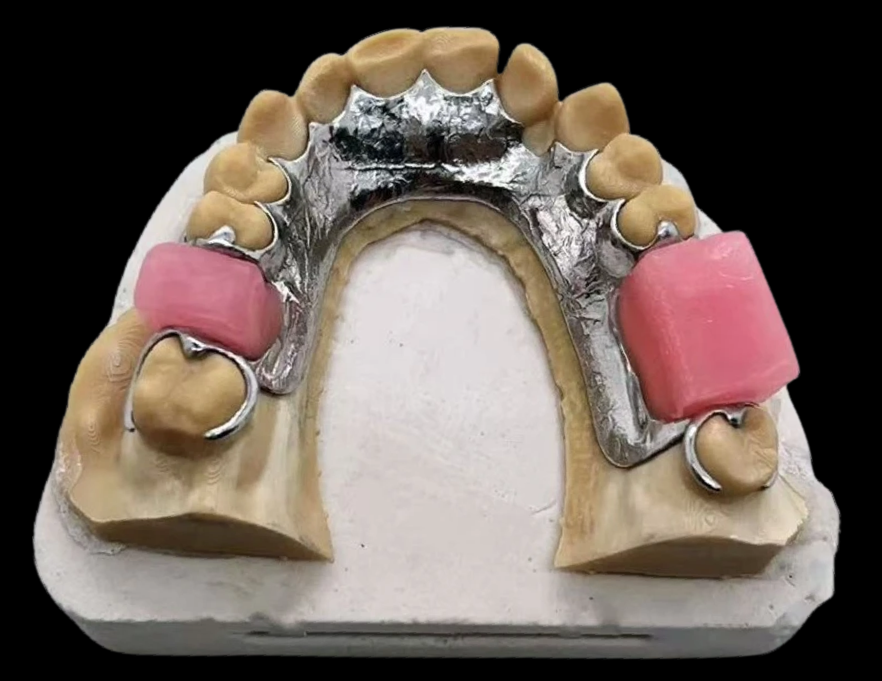 Framework MMR dental appliances