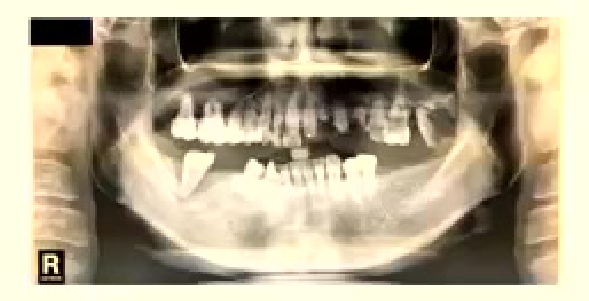Figure 1.26.