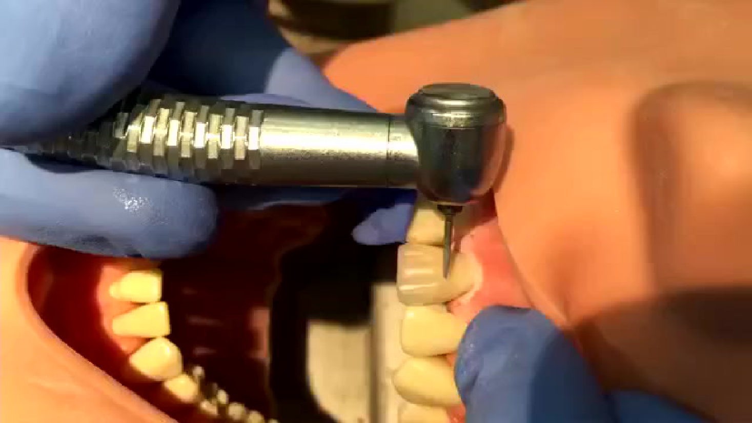 IN-TRAINING PERIODONTAL TREATMENT