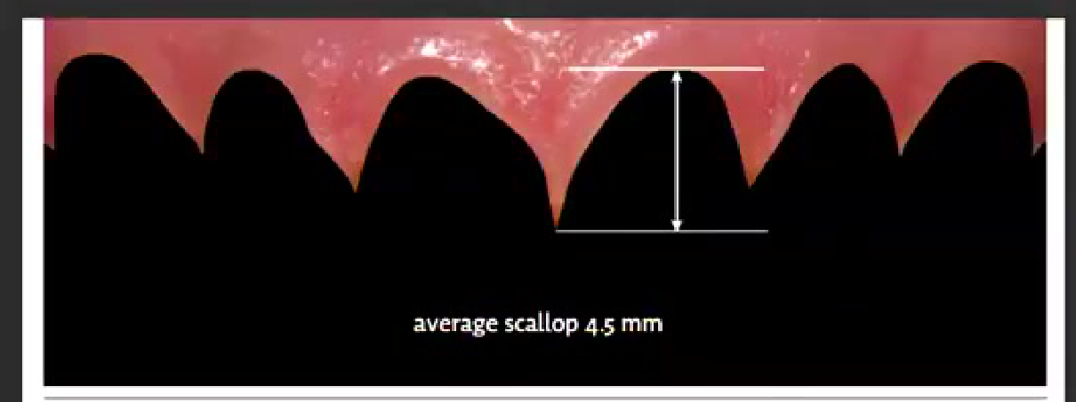 average scallop 4.5 mm