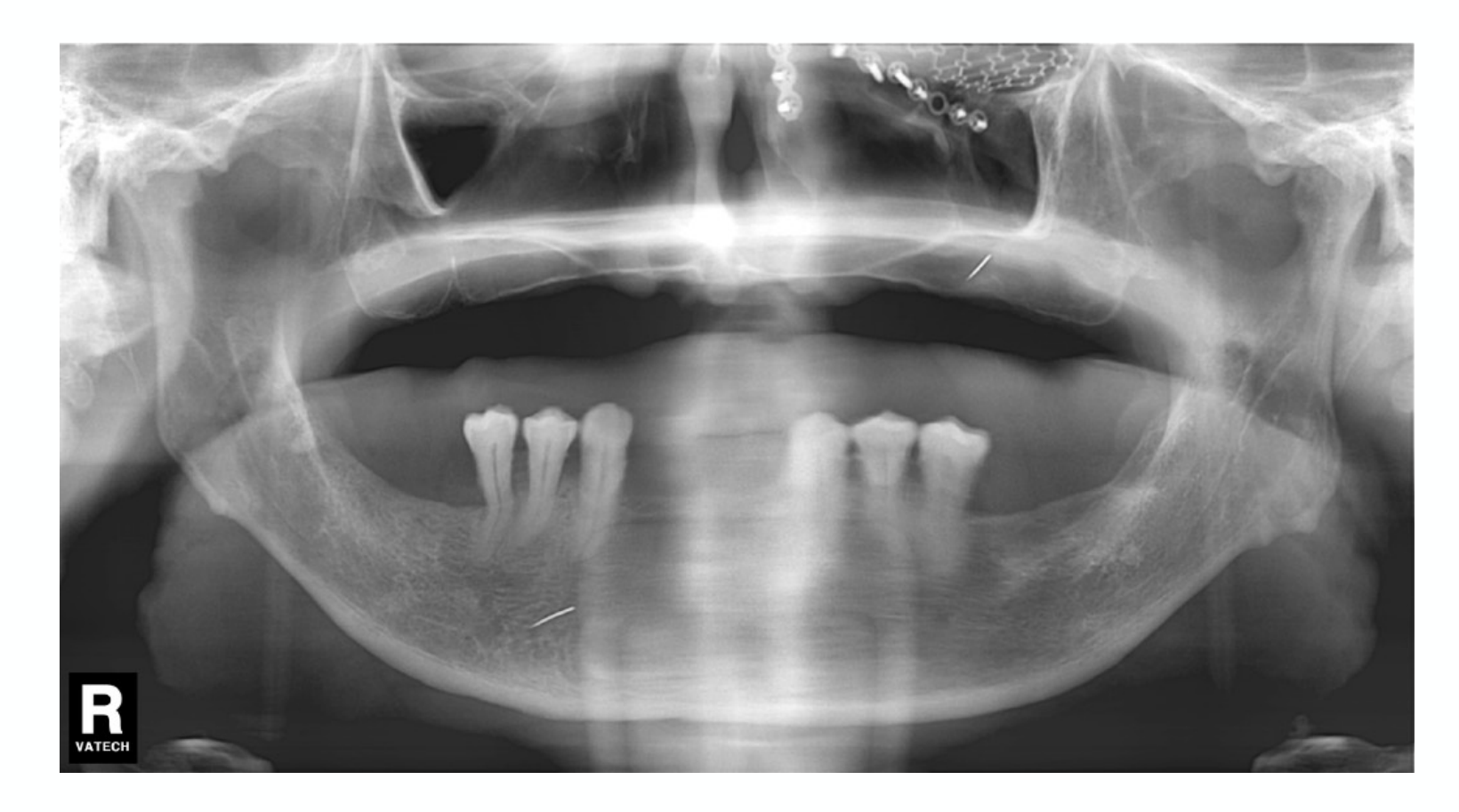 Radiograph}