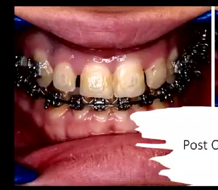 Post