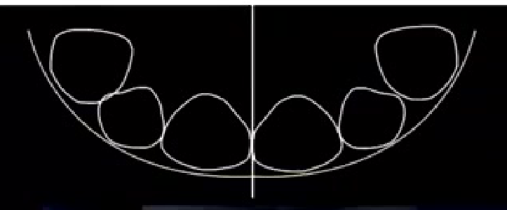 7. Twelve o'clock analysis