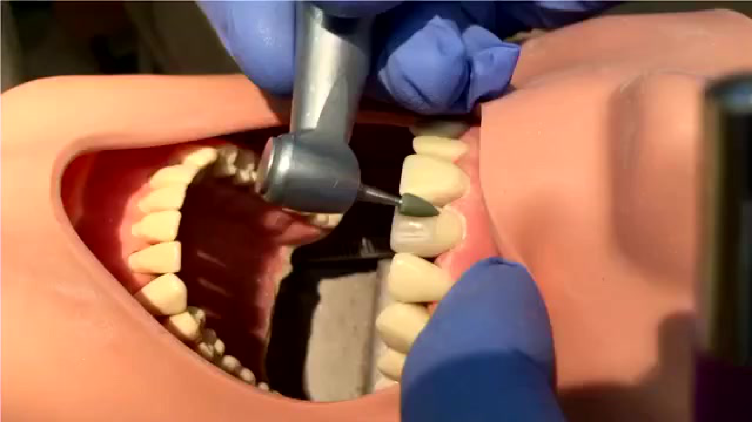 Dental Model Showing Dental Drill and Tooth